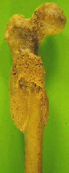 femurhealed_fa.gif (29986 bytes)